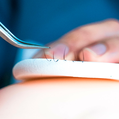 3_retirada_de_pestañas