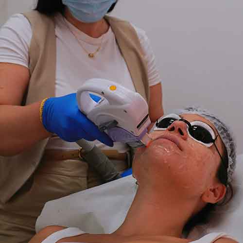 Labio-+-barbilla-+-menton