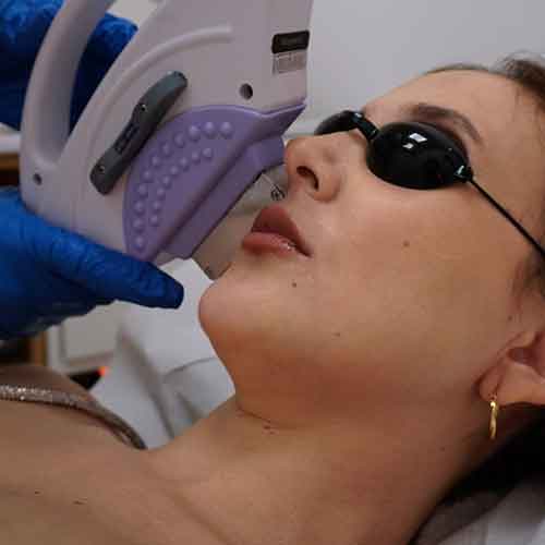 Pomulos-+--patillas2